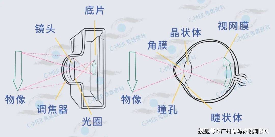 近视眼最新技术揭秘，小巷中的光明秘境探索